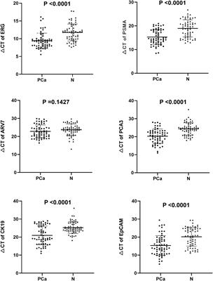 Effective Diagnosis of Prostate Cancer Based on mRNAs From Urinary Exosomes